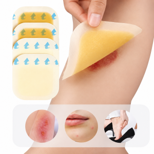 medical bordered hydrocolloid dressing waterproof artificial skin for pressure ulcer & bedsore care